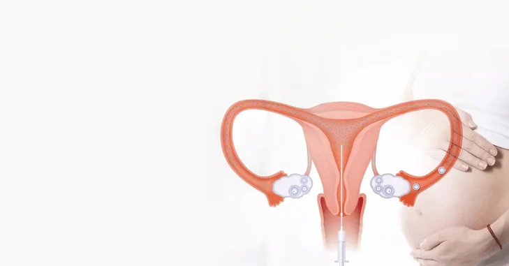 Ovulation Spotting vs. Implantation-Related Spotting